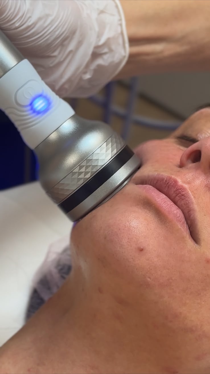 Detailaufnahme eines Applikators mit blau leuchtenden LEDs an Wange und Mundwinkel