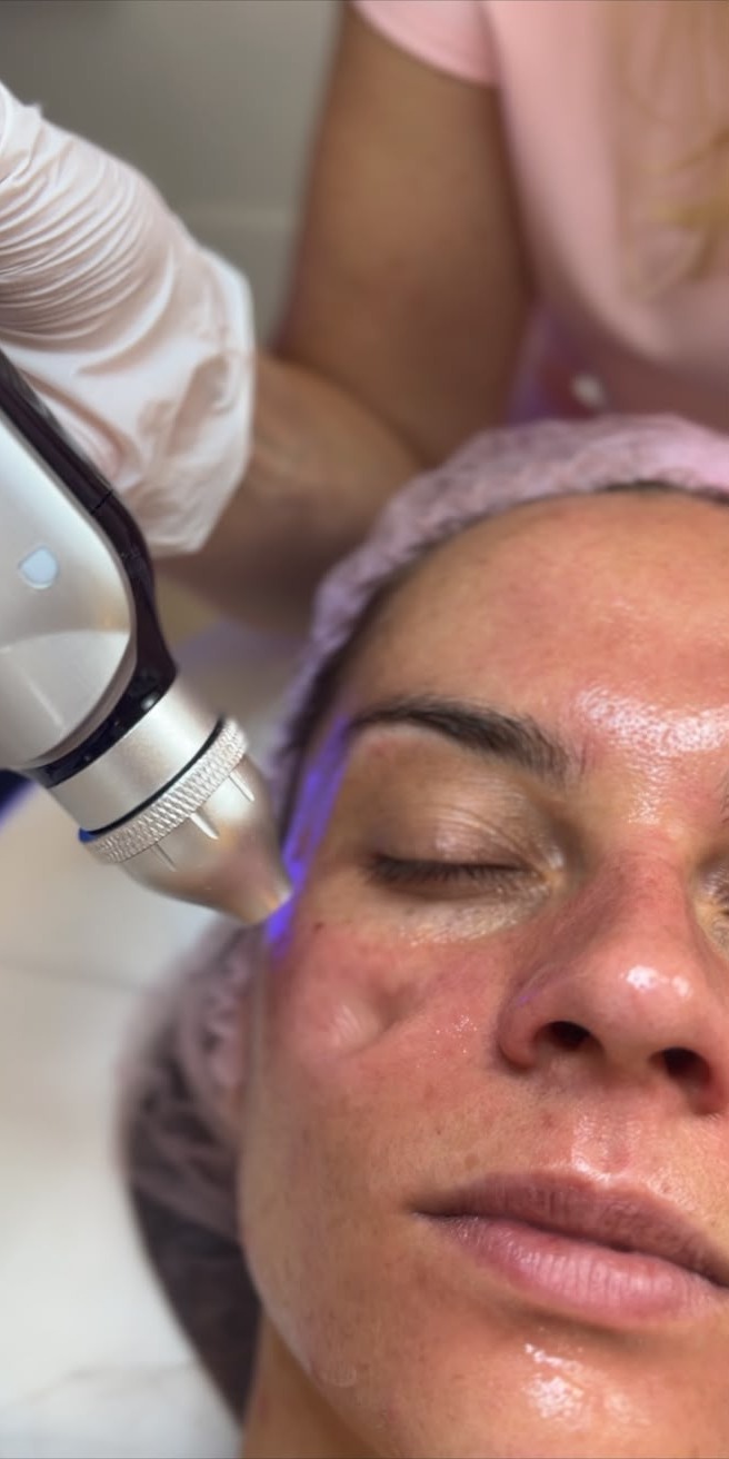 Gesichtsbehandlung mit einem Handstück mit blauem Licht an der Wange