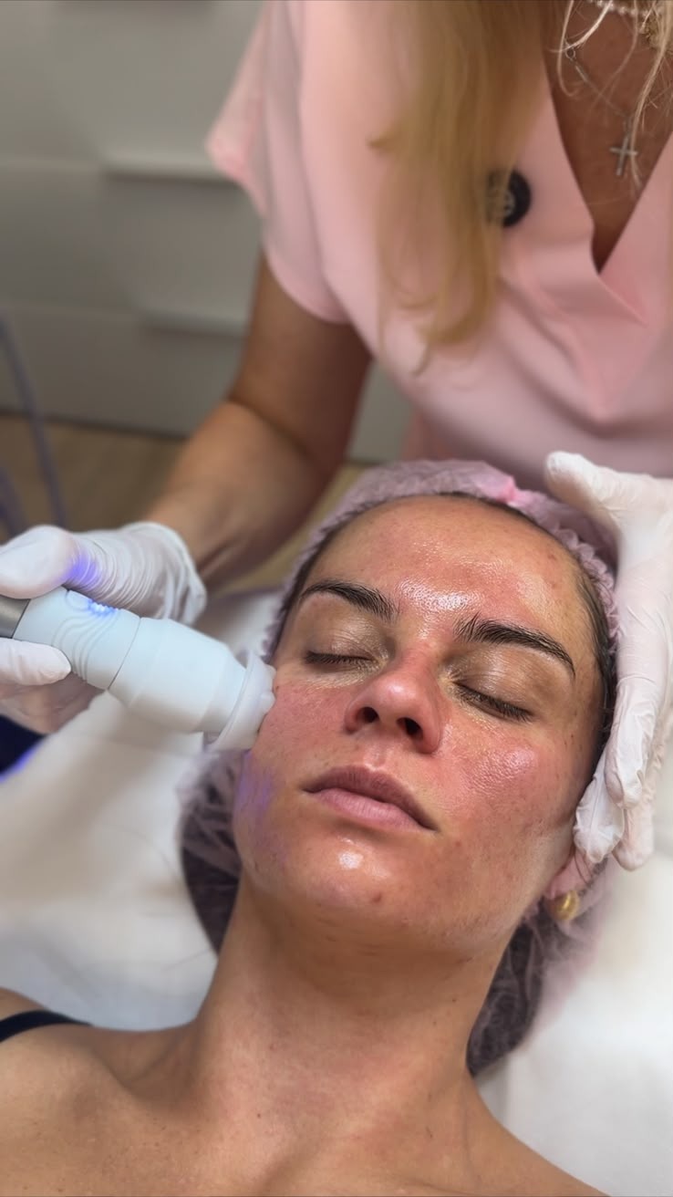 Apparative Gesichtsbehandlung mit einem blau leuchtenden Behandlungsstab